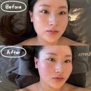 Brush | 해운대피부관리 에스테티아 마린시티점 윤곽관리 후기