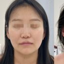 피부바디테라피 네이버블로그