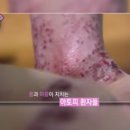 조아라한의원 네이버블로그