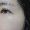 나성동_에스빌딩앞 | [세종피부과] 나성동 잇츠미의원 내돈내산 점빼기 + 미백 피코 토닝레이저 효과 후기