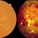 태전밝은안과의원 이미지