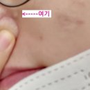 김용철산부인과의원 네이버블로그