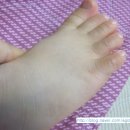 케이엔피씨 | 카페 지후맘 베이비실크 고보습용 익스트림 케어크림 체험단 체험후기 ] #2 갈라지고 튼 피부에 좋아요^^
