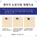 예미원피부과의원 | 눈밑지방재배치후기 덕분에 다시태어났어요^^