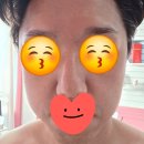 영광군청 | 영광에서 피부관리로 유명한 피부관리샵 에이치투라니 Beauty Shop!! 피부고민해결!!