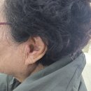 장애진단 받은 부산 70대 어르신, 지원금으로 구매한 루미티 보청기