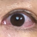 양산성모안과의원 이미지