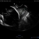 동탄제일병원 이미지