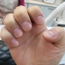 남일빌딩 | 손톱 물어뜯기 방지 교정 시술 후기 장한평 네일샵 유려한 뷰티