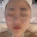 희스킨 이미지