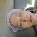 은서 피부관리