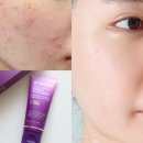 (주)바로팜 | 닥터멜락신 칼슘 본딩 페이셜 크림, 약국 피부장벽크림 후기