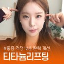 제이린 - 천안시 동남구 청수10길 47 | 서면 피부과 잘하는 곳, 티타늄 리프팅 효과와 티타늄리프팅 후기 확인 제이린의원