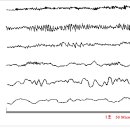 뇌파의 종류 이미지