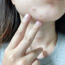 진메디케어 이미지