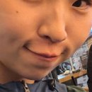 복코돼지 | 콧볼축소 한 후기(+매부리코,비익거상,복코교정)실밥제거후기