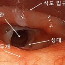 이편한서울이비인후과의원 | 쉰목소리 3개월 방치 후 역류성후두질환 진단… 식습관 바꾸고 좋아진 후기