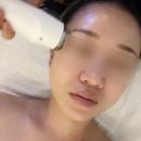회룡역 피부관리 :: 라비엘뷰티 , 픽사드키트 관리 후기 💫