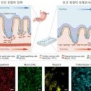 장상피화생 원인 증상 치료 장상피화생에 음식 헬리코박터균 장상피화생 이미지