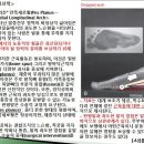 [11강-발목/발-10,11](89강,90강) 편평발, 오목발, 목말밑관절과 가로발목뼈관절의 결합된 작용 이미지