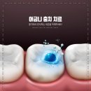 강동뉴욕치과의원 이미지