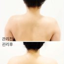 라인 아로마 | 장항동 피부관리 추천 스파더힐 아로마 윤곽관리 브이라인된 후기