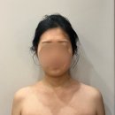 올인원웨딩 | [인천 송도 에스테틱 | 온드 에스세틱] 얼굴 윤곽 & 승모근 & 팔뚝 상체 올인원 웨딩관리 강추 솔직 후기