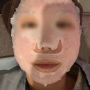 수스킨 | 역삼 피부과 티시보 스킨부스터 후기 다운타임, 통증, 붓기, 부작용