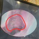 좋은하루이비인후과의원 | 김해 내동 서울 이비인후과 ♡ 아데노이드 편도절제술 검사 수술예약