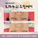 태조한의원 | 천안피부관리 추천 두정 오마주21스킨케어 찐 전문가의 여드름관리