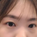 눈치코치 위드렌즈 김해 장유점 이미지