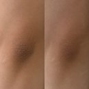 투브로우즈&셀스테틱 둔산점 | [ 대전 둔산 투브로우즈&셀스테틱 ] 멜라닌 케어 미백...전문 | 셀핏 바디관리 ⭐️내 돈 내산 솔직후기 |