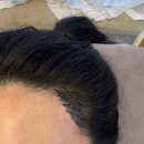 쁘띠헤어 | [대구 뷰티샵 추천] 반월당 헤어라인 맛집 쁘띠럭키✨ M자 이마 콤플렉스 탈출 후기💕