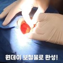 일정치과기공소 이미지