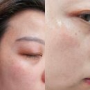 현이화장품 - 안양시 동안구 동안로 162 | 부산 서면 스킨부스터 내 돈 내산만큼 꼼꼼한 리쥬란 HB 솔직 후기(통증, 효과 정리)