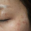 추소아청소년과의원 이미지