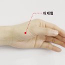 【수태음폐경(手太陰肺經)】 〔수태음폐경 (LU) ＞ LU11 어제(魚際)〕 이미지