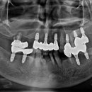 연세백마치과의원 이미지