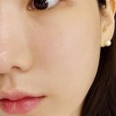 레이져 | 강남피부과 버츄rf 풀페이스 고주파 레이져 모공 타이트닝 후기