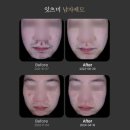 잇츠미의원 이미지