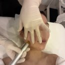 구로-구로-구로-1080 | 하이필스킨 구로본점 :: 구로 좁쌀여드름 관리 피부 맞춤관리 후기