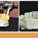 다이안치과기공소 이미지