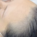 임수희 두피헤어센스 | 신사역두피관리 헤어라인 두피커버 전문점 닷센스 신사 후기