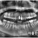 태인치과의원 네이버블로그