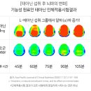 가슴이 답답한 증상 어떤것이 문제일까? 이미지