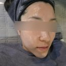 이쁌뷰티 | 연희동 스킨플래닝 연희동 피부관리 서구 스킨플래닝 이쁌뷰티