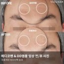 모비디크