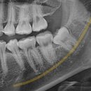 휴아치과의원 이미지