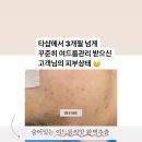 선 피부샵