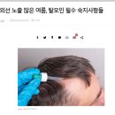 고야앤드미디어 | 탈모증상완화 유다모 남자탈모샴푸 구입 후기